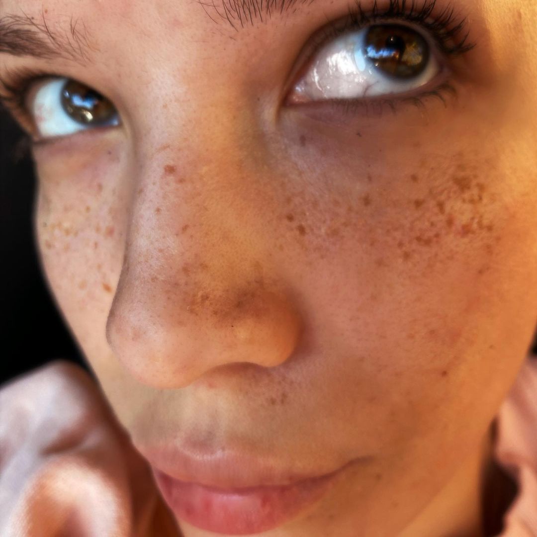 SINGER HALSEY SHOWING OFF HER FRECKLES